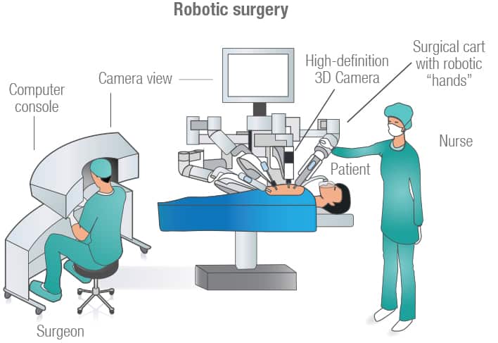 Robotc Surgery